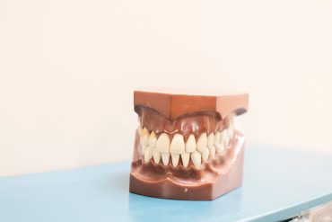 dental-model-showing-teeth